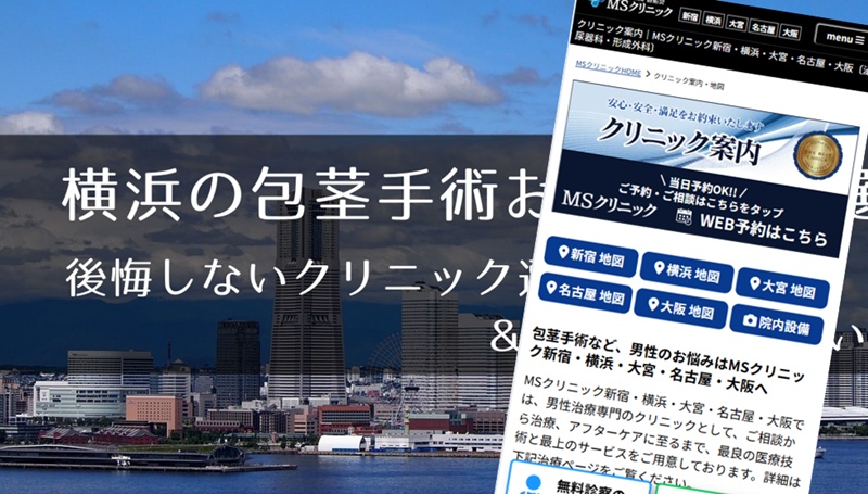 横浜でおすすめの包茎手術クリニック