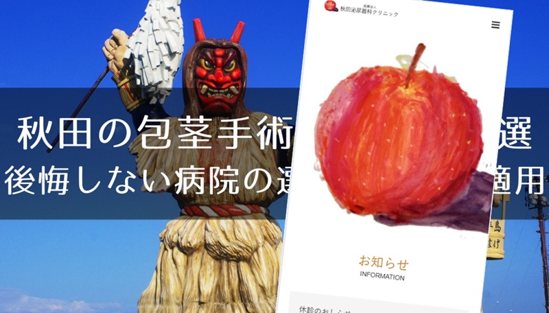秋田でおすすめの包茎手術クリニック