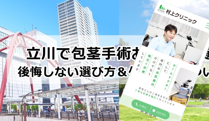 立川でおすすめの包茎手術クリニック