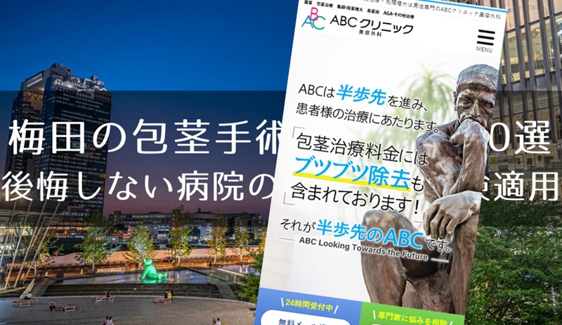梅田の包茎手術おすすめクリニック