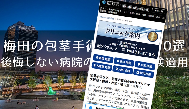 梅田の包茎手術おすすめクリニック
