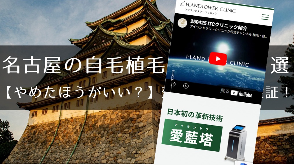 名古屋のおすすめ自毛植毛