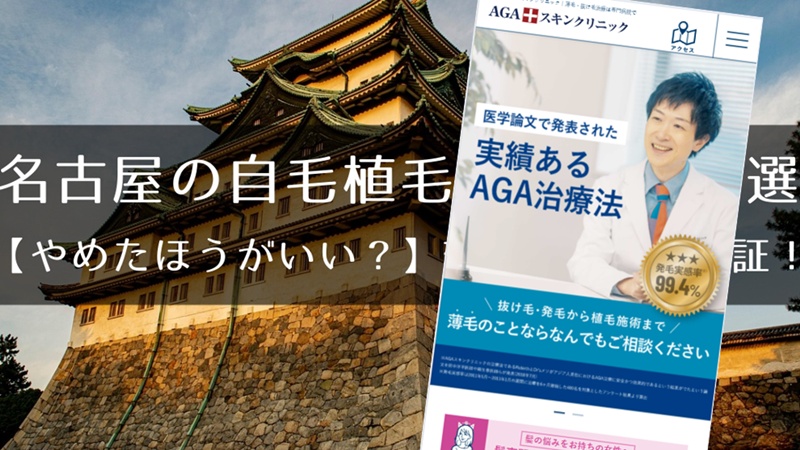 名古屋のおすすめ自毛植毛