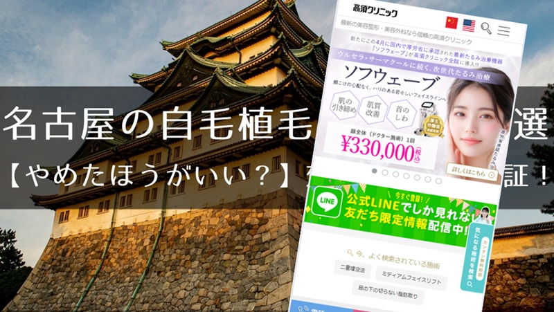 名古屋のおすすめ自毛植毛