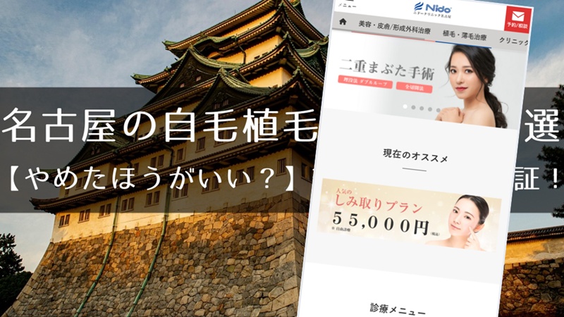 名古屋のおすすめ自毛植毛