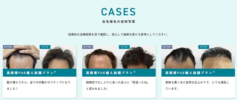 東京植毛クリニック